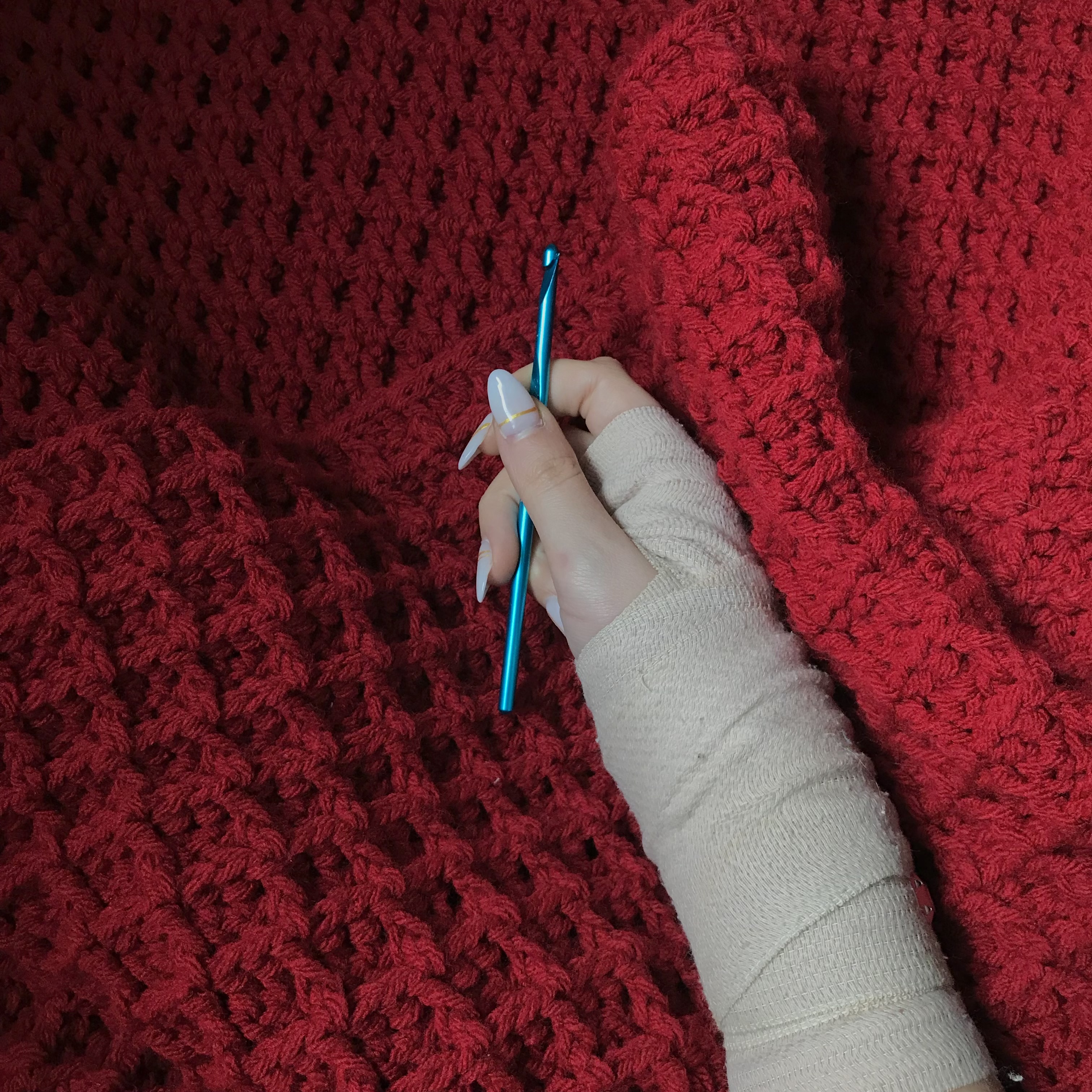 hand in cast holding crochet hook